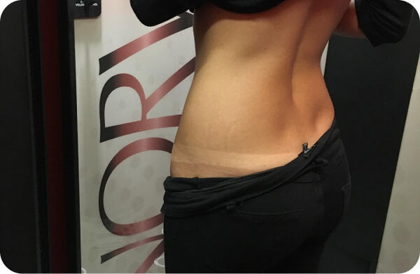 Close-up of hip tan line highlighting results taught in live spray tan course in Charlotte
